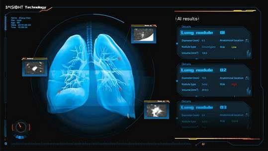 為了我們的健康 以AI賦能智能抗疫，數據處理與存儲支持服務探析